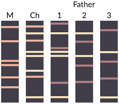 paternity-dna-test-for-someone-who-died-dead-nyc-lab-02